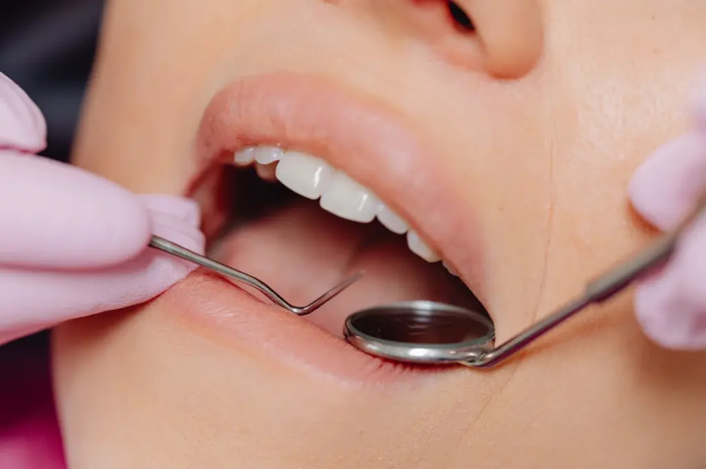 A dental mirror and probe being used to examine upper teeth