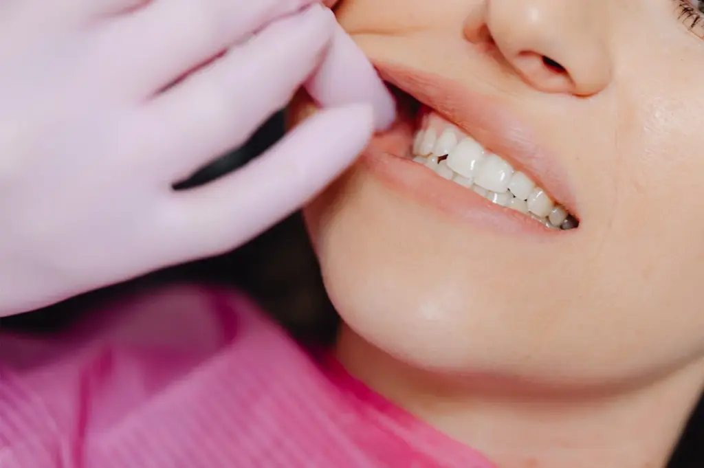 A close-up of a dental examination in progress
