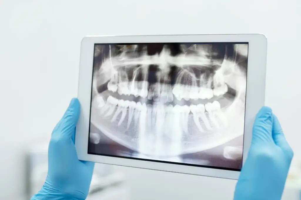 A gloved clinician holding a tablet showing a panoramic dental X-ray