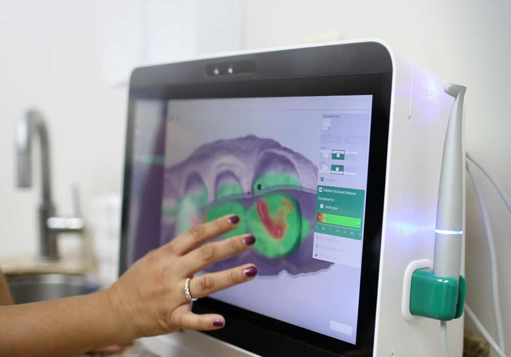 A digital intraoral scanner in the treatment room at Diamond Dental in Tulsa